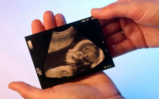 На каких сроках проводят плановые УЗИ во время беременности