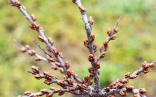 Особенности лечения пиелонефрита во время беременности