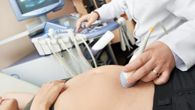 Как обнаружить антенатальную гибель плода